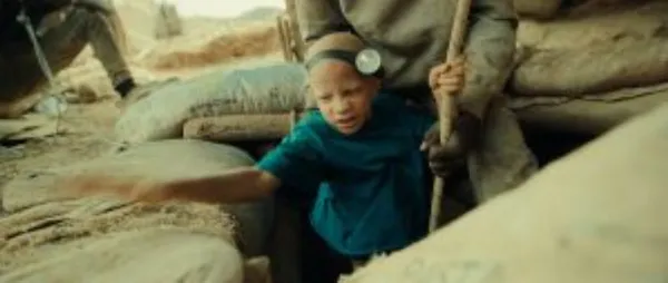 The Boy With White Skin